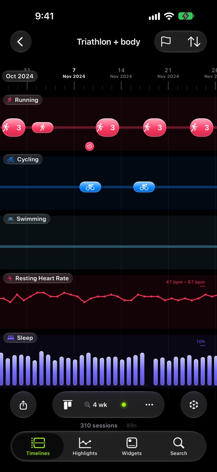 The axis — One proportional time axis for every lane. No second scale, ever.